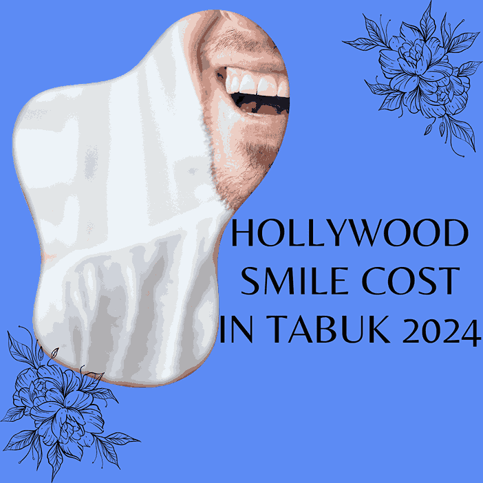 Hollywood smile cost in Tabuk 2024 Kawaib