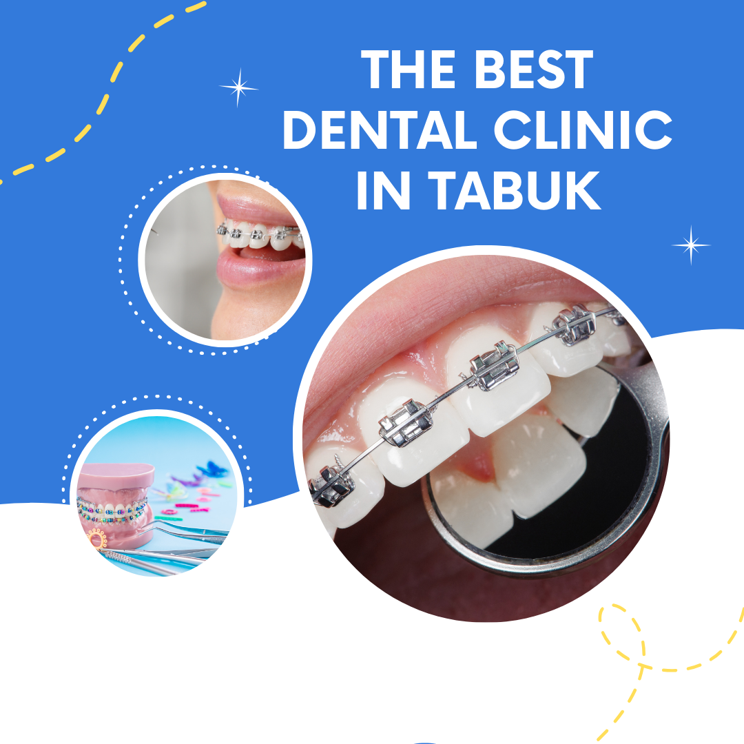 How You Can Do top dentist in Dwarka In 24 Hours Or Less For Free