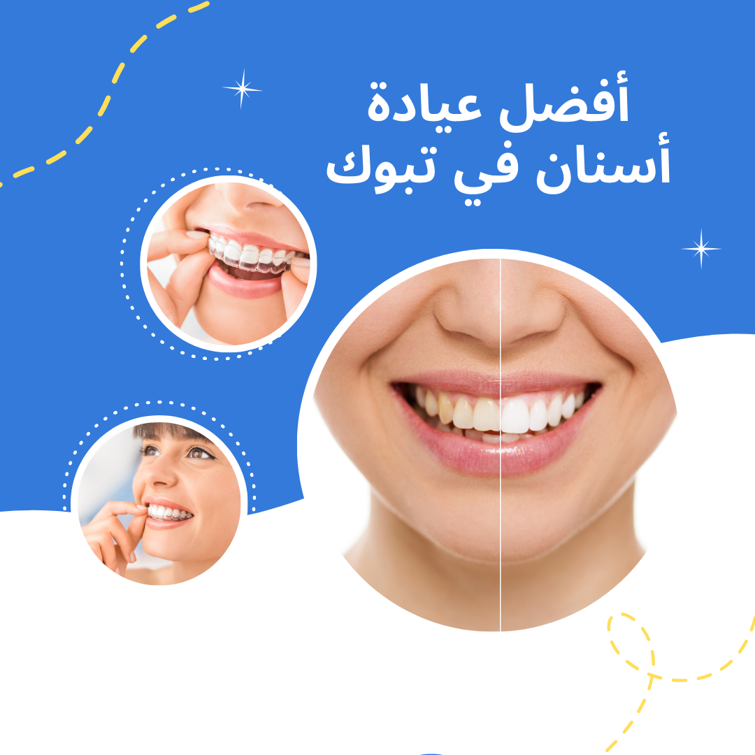 أفضل عيادة أسنان في تبوك