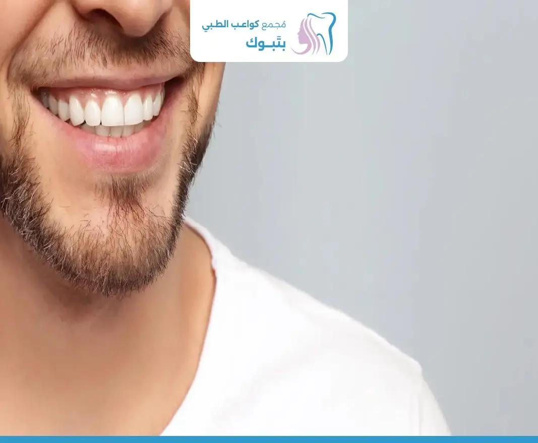ابتسامة هوليود في السعودية